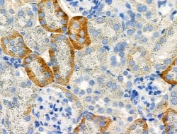 Invitrogen Phospho-TAOK2 (Ser181) Polyclonal Antibody 100 &mu;L; Unconjugated:Antibodies,