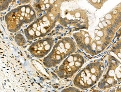 Invitrogen Phospho-TAOK2 (Ser181) Polyclonal Antibody 100 &mu;L; Unconjugated:Antibodies,