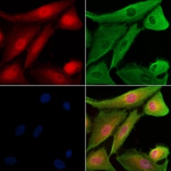 Invitrogen Phospho-TAOK2 (Ser181) Polyclonal Antibody 100 &mu;L; Unconjugated:Antibodies,