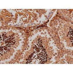 Phospho-Tau (Ser579) Polyclonal Antibody:Antibodies, Polyclonal
