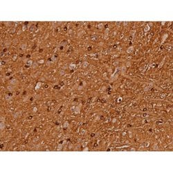 Phospho-Tau (Ser579) Polyclonal Antibody:Antibodies, Polyclonal