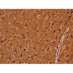 Phospho-Tau (Ser579) Polyclonal Antibody:Antibodies, Polyclonal