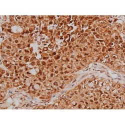 Phospho-Tau (Ser579) Polyclonal Antibody:Antibodies, Polyclonal