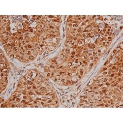 Phospho-Tau (Ser579) Polyclonal Antibody:Antibodies, Polyclonal