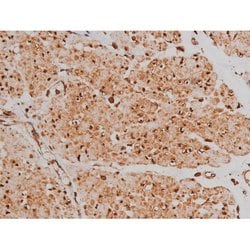 Phospho-Tau (Ser579) Polyclonal Antibody:Antibodies, Polyclonal