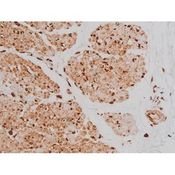 Phospho-Tau (Ser579) Polyclonal Antibody:Antibodies, Polyclonal