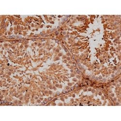 Phospho-Tau (Ser579) Polyclonal Antibody:Antibodies, Polyclonal