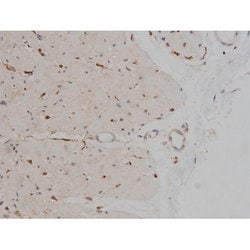 Invitrogen Phospho-Tau (Ser721) Polyclonal Antibody 100 &mu;L; Unconjugated:Antibodies,