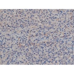 Invitrogen Phospho-Tau (Ser739) Polyclonal Antibody 100 μL; Unconjugated:Antibodies,