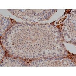 Invitrogen Phospho-Tau (Ser739) Polyclonal Antibody 100 μL; Unconjugated:Antibodies,