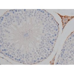 Invitrogen Phospho-Tau (Ser739) Polyclonal Antibody 100 μL; Unconjugated:Antibodies,