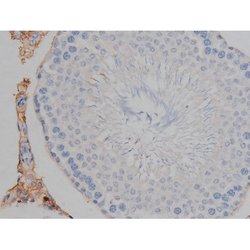 Invitrogen Phospho-Tau (Ser739) Polyclonal Antibody 100 μL; Unconjugated:Antibodies,