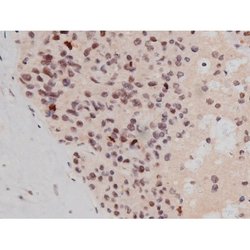 Phospho-Tau (Thr498) Polyclonal Antibody:Antibodies, Polyclonal