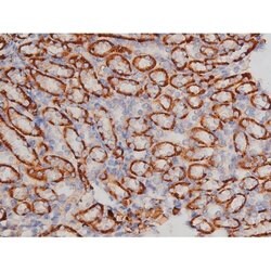Phospho-Tau (Thr498) Polyclonal Antibody:Antibodies, Polyclonal