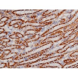 Phospho-Tau (Thr498) Polyclonal Antibody:Antibodies, Polyclonal