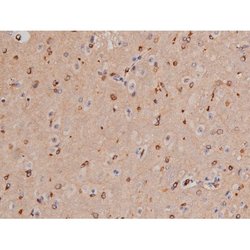Phospho-Tau (Thr498) Polyclonal Antibody:Antibodies, Polyclonal