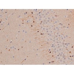Phospho-Tau (Thr498) Polyclonal Antibody:Antibodies, Polyclonal