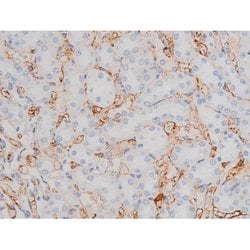 Phospho-Tau (Thr498) Polyclonal Antibody:Antibodies, Polyclonal