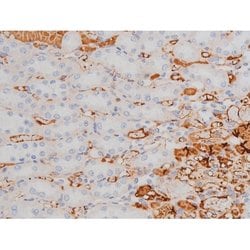 Phospho-Tau (Thr498) Polyclonal Antibody:Antibodies, Polyclonal