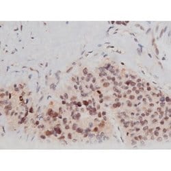 Phospho-Tau (Thr498) Polyclonal Antibody:Antibodies, Polyclonal