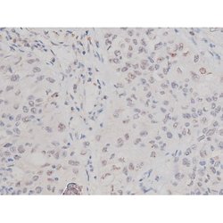 Phospho-Tau (Thr498) Polyclonal Antibody:Antibodies, Polyclonal