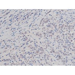 Phospho-Tau (Thr498) Polyclonal Antibody:Antibodies, Polyclonal