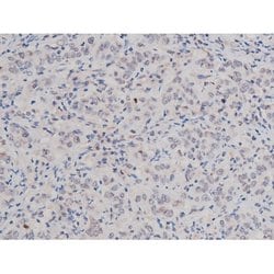 Phospho-Tau (Thr498) Polyclonal Antibody:Antibodies, Polyclonal