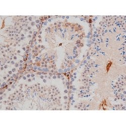 Phospho-Tau (Thr498) Polyclonal Antibody:Antibodies, Polyclonal