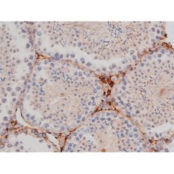 Phospho-Tau (Thr498) Polyclonal Antibody:Antibodies, Polyclonal