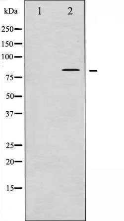 Phospho-Tau (Thr498) Polyclonal Antibody:Antibodies, Polyclonal