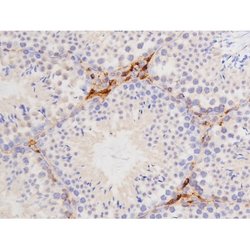 Phospho-Tau (Thr529) Polyclonal Antibody:Antibodies, Polyclonal
