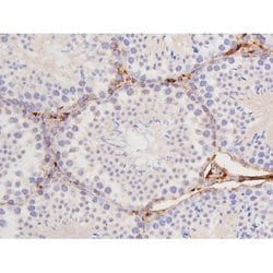 Phospho-Tau (Thr529) Polyclonal Antibody:Antibodies, Polyclonal