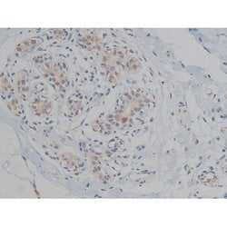 Invitrogen Phospho-Tau (Thr548) Polyclonal Antibody 100 μL; Unconjugated:Antibodies,