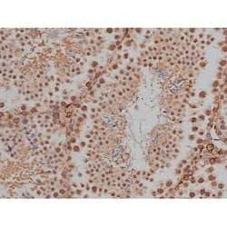 Invitrogen Phospho-Tau (Thr548) Polyclonal Antibody 100 μL; Unconjugated:Antibodies,