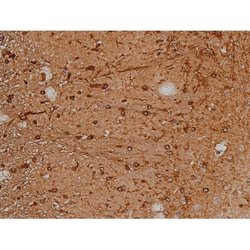 Invitrogen Phospho-Tau (Thr548) Polyclonal Antibody 100 μL; Unconjugated:Antibodies,