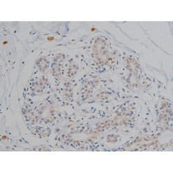 Invitrogen Phospho-Tau (Thr548) Polyclonal Antibody 100 μL; Unconjugated:Antibodies,