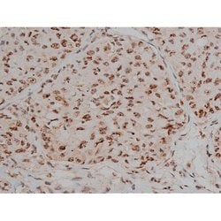 Invitrogen Phospho-Tau (Thr548) Polyclonal Antibody 100 μL; Unconjugated:Antibodies,