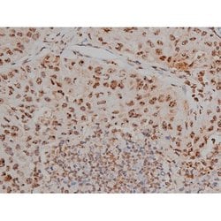 Invitrogen Phospho-Tau (Thr548) Polyclonal Antibody 100 μL; Unconjugated:Antibodies,