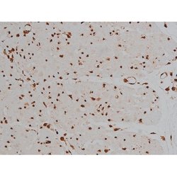 Invitrogen Phospho-Tau (Thr548) Polyclonal Antibody 100 μL; Unconjugated:Antibodies,