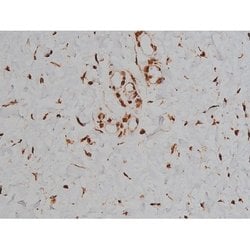 Invitrogen Phospho-Tau (Thr548) Polyclonal Antibody 100 μL; Unconjugated:Antibodies,