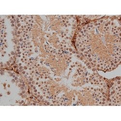 Invitrogen Phospho-Tau (Thr548) Polyclonal Antibody 100 μL; Unconjugated:Antibodies,