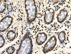 Invitrogen Phospho-TDP-43 (Ser409, Ser410) Polyclonal Antibody 100 &mu;L;