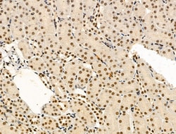 Invitrogen Phospho-TDP-43 (Ser409, Ser410) Polyclonal Antibody 100 &mu;L;