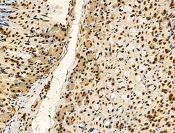 Invitrogen Phospho-TDP-43 (Ser409, Ser410) Polyclonal Antibody 100 &mu;L;