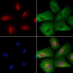 Invitrogen&trade;&nbsp;Phospho-TFEB (Ser211) Polyclonal Antibody