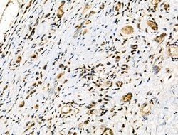 Invitrogen&trade;&nbsp;Phospho-TFEB (Ser211) Polyclonal Antibody