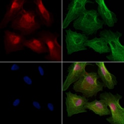Invitrogen Phospho-TOPBP1 (Ser1138) Polyclonal Antibody 100 &mu;L; Unconjugated:Antibodies,
