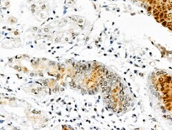 Invitrogen Phospho-TOPBP1 (Ser1138) Polyclonal Antibody 100 &mu;L; Unconjugated:Antibodies,