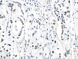 Invitrogen Phospho-TOPBP1 (Ser1138) Polyclonal Antibody 100 &mu;L; Unconjugated:Antibodies,