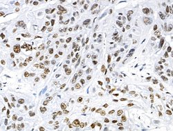 Invitrogen Phospho-TOPBP1 (Ser1138) Polyclonal Antibody 100 &mu;L; Unconjugated:Antibodies,